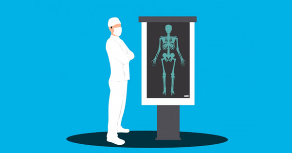 Mobile X-Ray Units and Aspects to Consider While Buying them