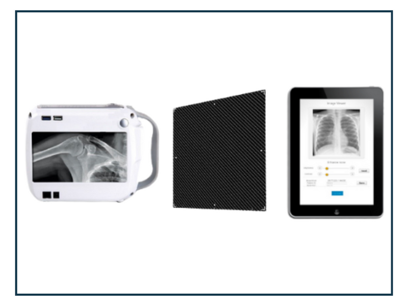 Benefits of Mobile X-ray Equipment
