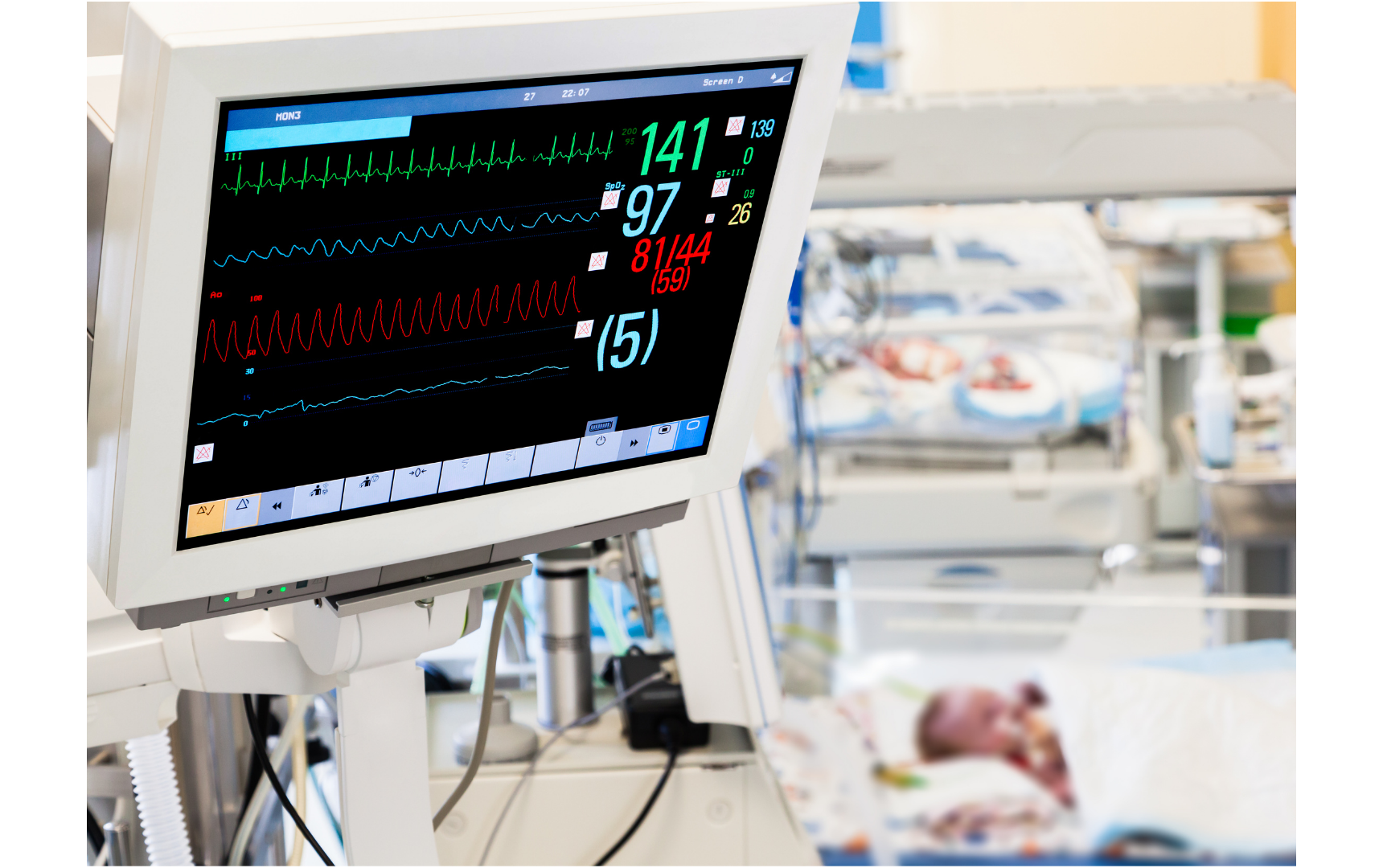 Patient Monitors Patient Monitoring Alarms Tomlin Medical