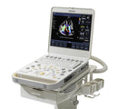 Philips CX50 Ultrasound System With 2 Transducers [Used]