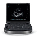 2021 Sonosite Edge II Ultrasound System With 4 Transducers [Refurbished]