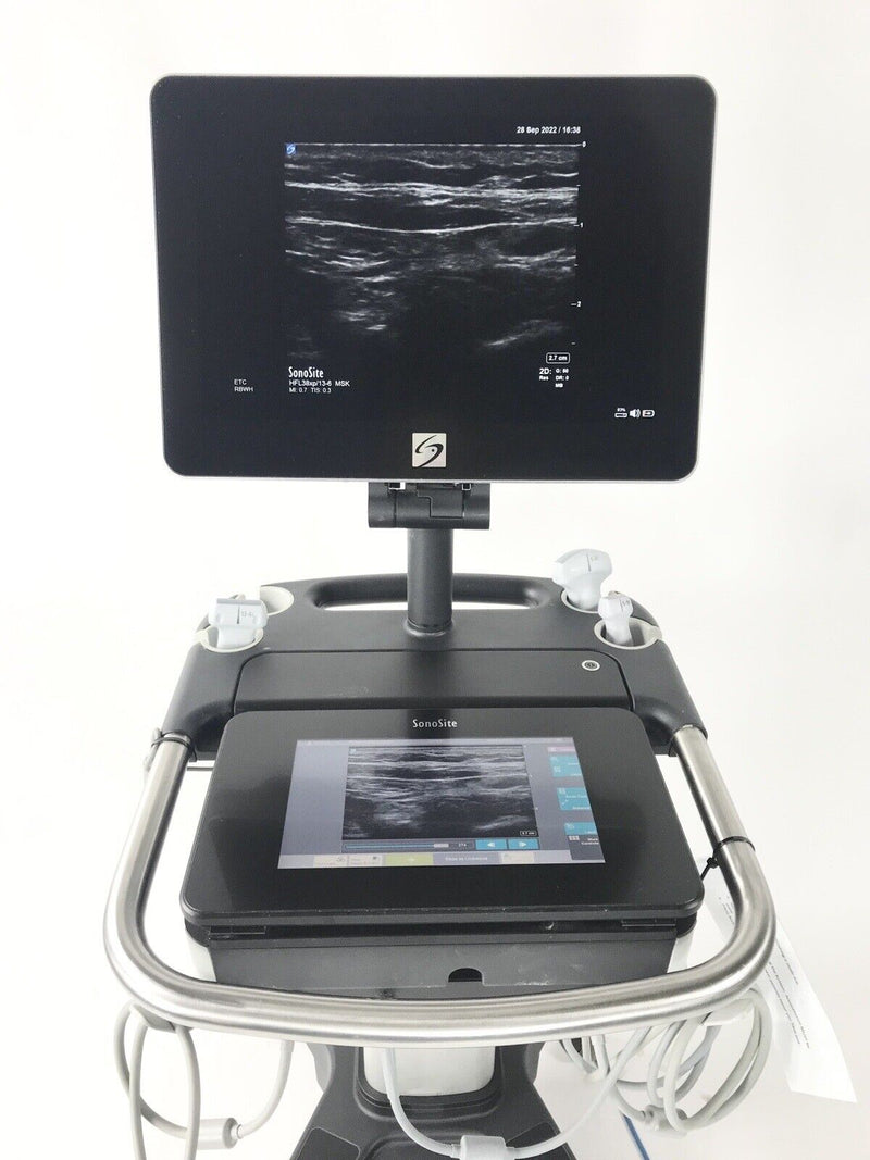 Sonosite X Porte Flat Touch Screen Ultrasound System With 3 Transducers [Refurbished]