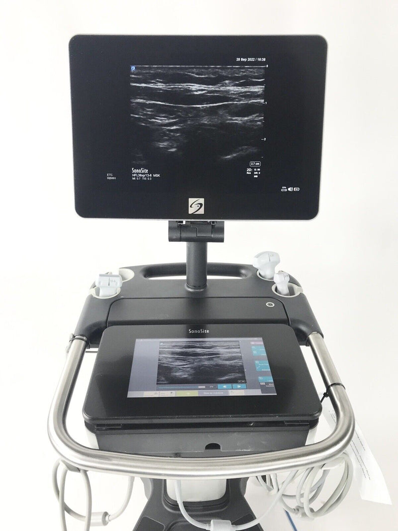 Sonosite X Porte Flat Touch Screen Ultrasound System With 3 Probes [Refurbished]