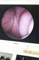 Flexicam Mobile [Refurbished]