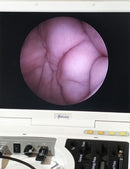 Flexicam Mobile [Refurbished]