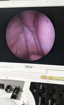 Flexicam Mobile [Refurbished]