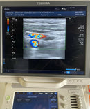 Toshiba Aplio 500 Ultrasound System With 2 Transducers [Refurbished]
