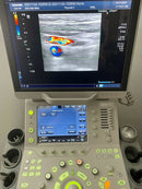Toshiba Aplio 500 Ultrasound System With 2 Transducers [Refurbished]
